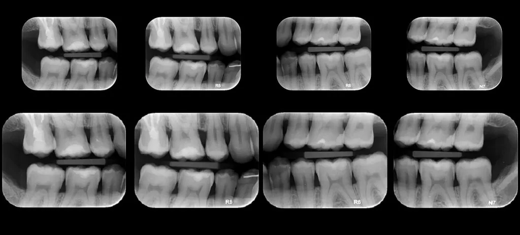 Radiografía Panorámica